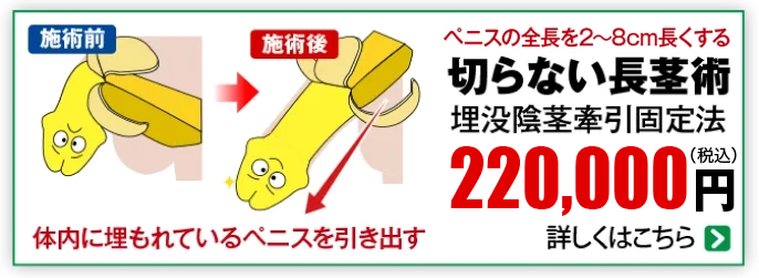 切らない長茎術
                        220,000                        円