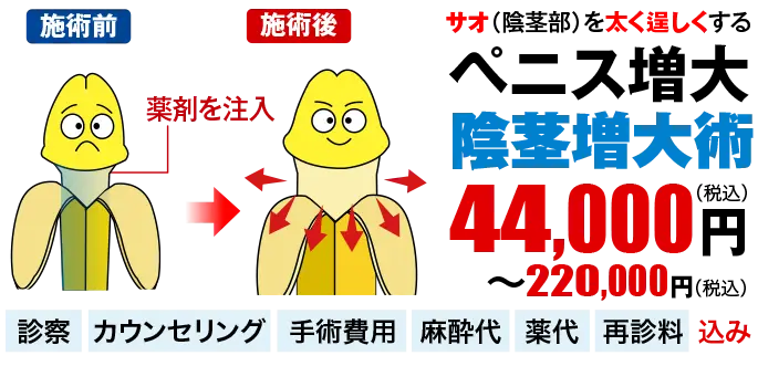 ペニス増大・陰茎増大術