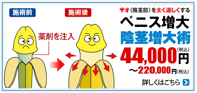 ペニス増大 陰茎増大術44,000円