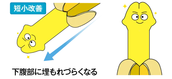 短小ペニスの改善・増大がバレない