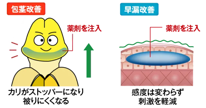 包茎の改善・早漏の改善効果